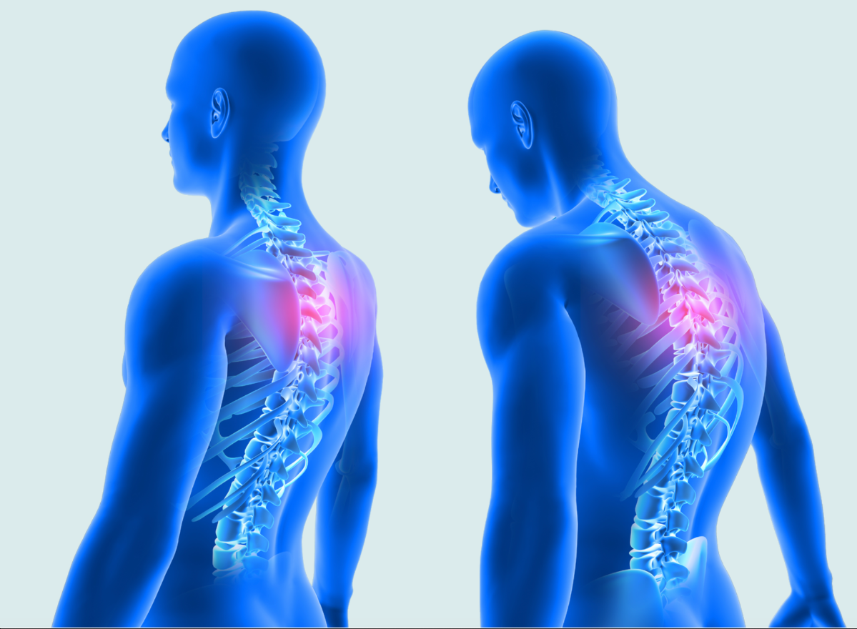 Exercise for the spine